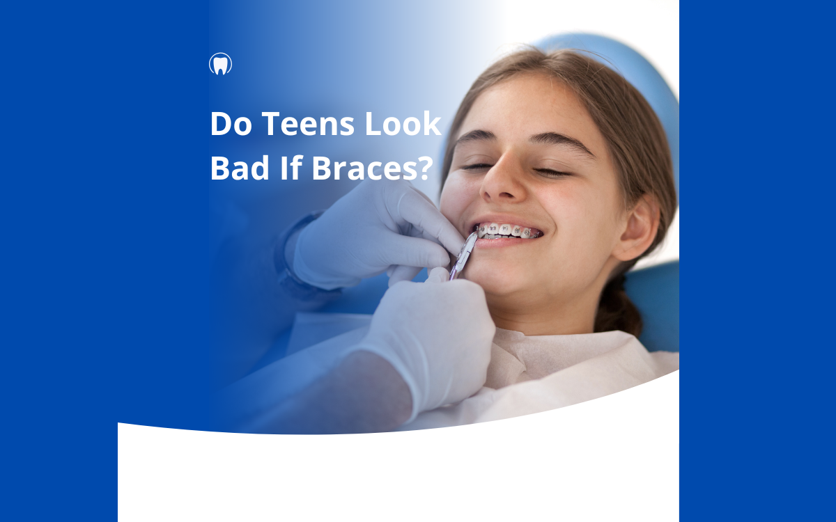 Do Teens Look Bad If Braces?